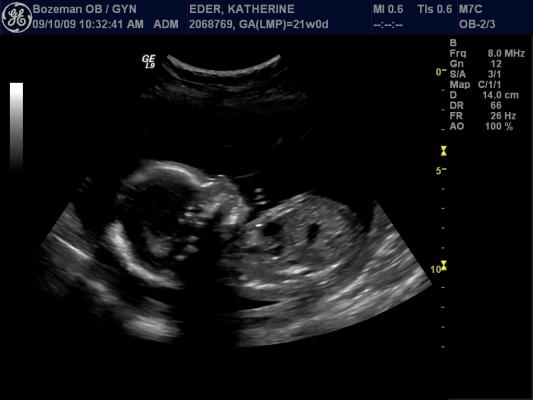 Baby pictures