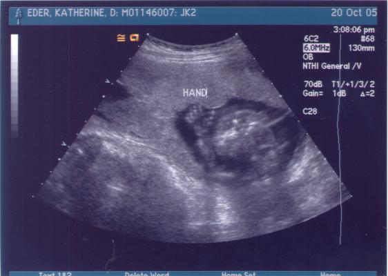 It's a hand!