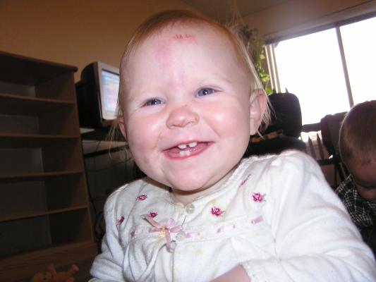 Sarah has four teeth with which to smile really big.