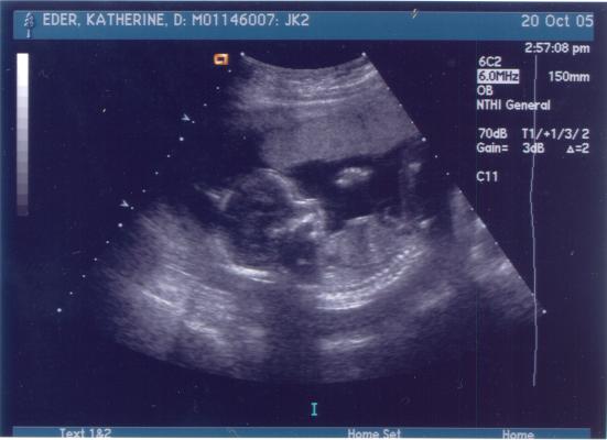Our new baby via ultrasound.