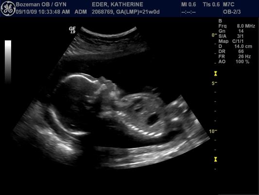 It's a boy!