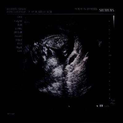 Our baby is healthy