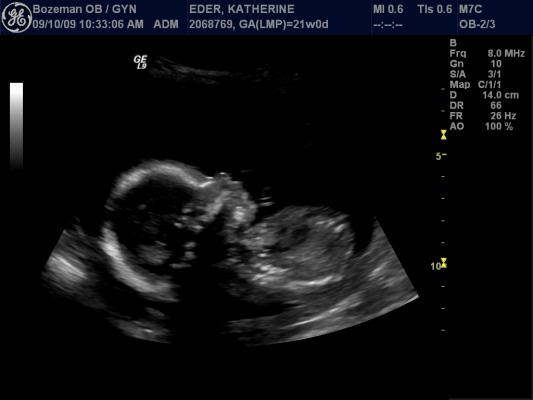 Ultrasound pictures