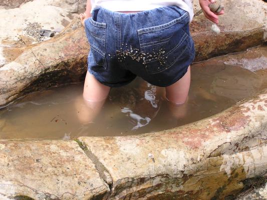 Noah has a bunch of little rocks on his bottom.