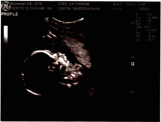 Ultrasound profile
