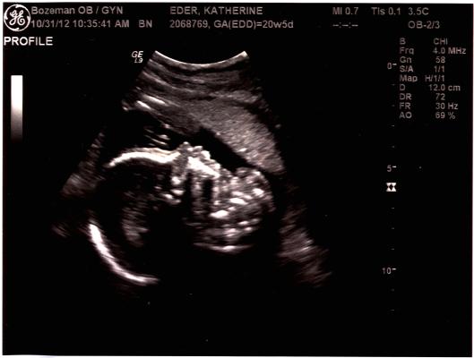 Ultrasound profile