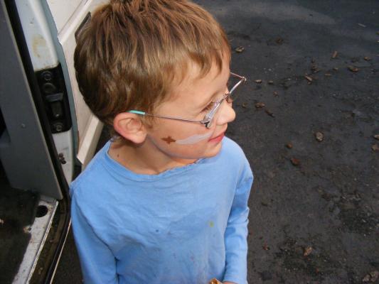 Noah with a sward on his cheek.