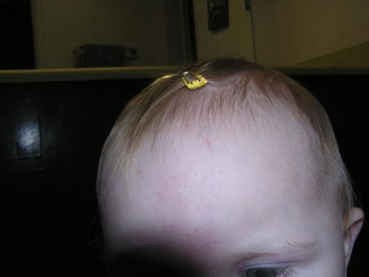 There are Sarah's hair clips.