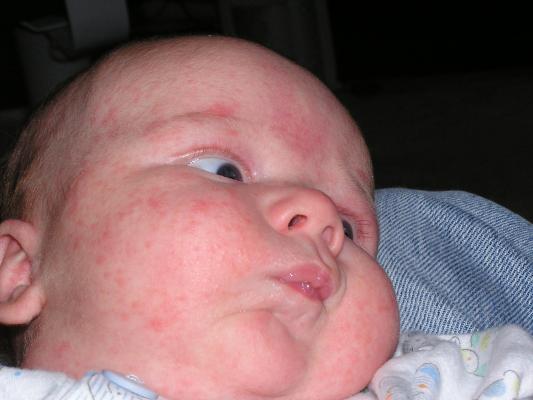 Noah looking satisfied with a tummy full of milk.