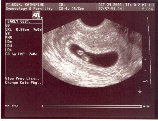 Here the baby and the yoke that feeds him can be clearly seen.