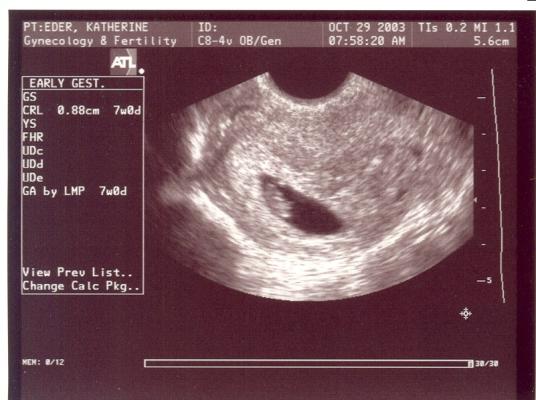 Baby is seven weeks old in this picture.